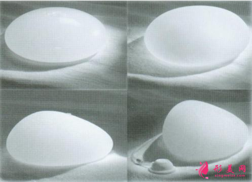 假體隆胸術(shù)后會影響哺乳嗎