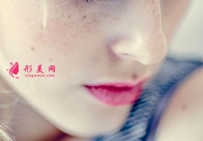 激光祛雀斑影響正常上班嗎