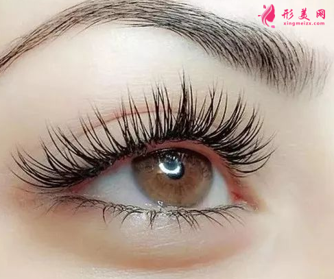 廣州開眼角術(shù)后要注意的事項