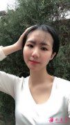 廣東韓妃整形陳坦做線雕真實(shí)案例分享，大家?guī)臀铱纯葱Ч貌缓?></a><p class=