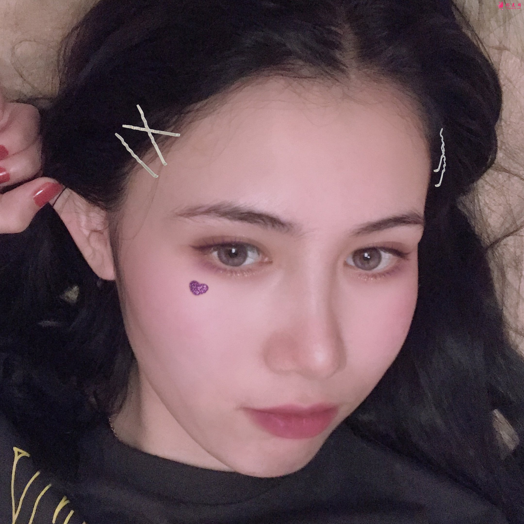 熱瑪吉術(shù)后