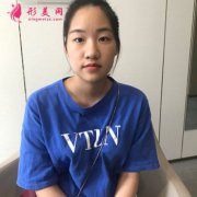 上海美萊吳海龍做雙眼皮怎么樣?雙眼皮真實案例分享~