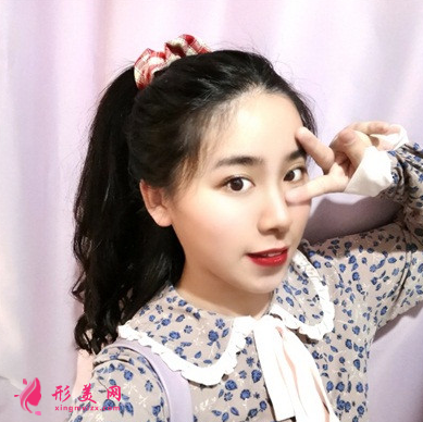 天姿醫(yī)療美容醫(yī)院李烈面吸案例