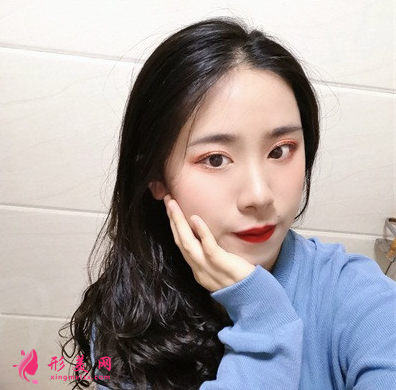 天姿醫(yī)療美容醫(yī)院李烈面吸案例