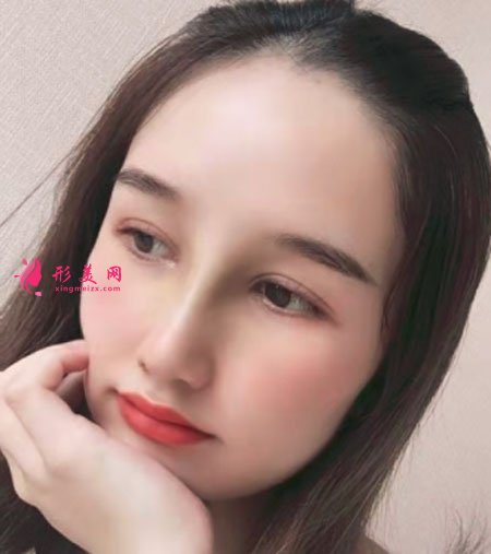 武漢韓辰醫(yī)療美容醫(yī)院吳輝鼻部整形案例對(duì)比圖 武漢韓辰醫(yī)療美容鼻部多項(xiàng)案例
