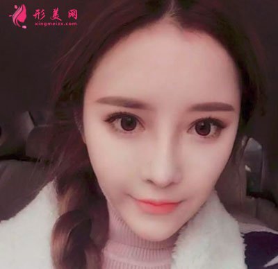 上海喜美醫(yī)療美容鼻部修復(fù)案例
