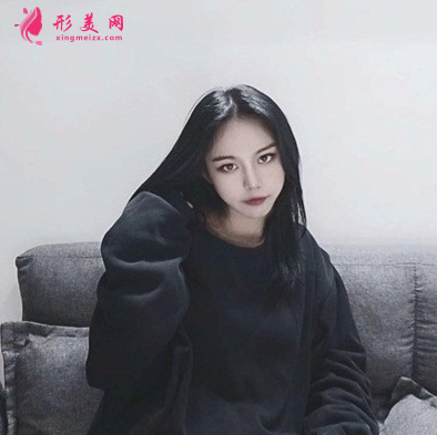 成都藝星周順波隆鼻效果怎么樣_假體硅膠隆鼻_真人案例