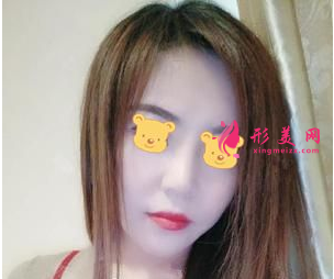成都成美鄭敏做鼻子怎么樣？