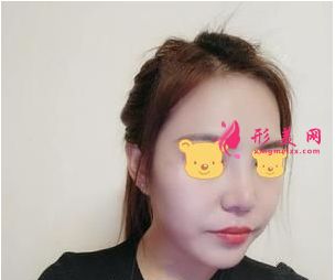 成都成美鄭敏做鼻子怎么樣？