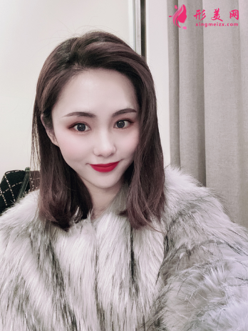 成都美綻美整形美容醫(yī)院陳宇做的眼綜合