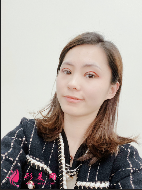 成都美綻美整形美容醫(yī)院陳宇做的眼綜合