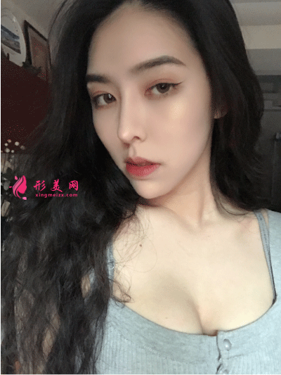 隆胸一個(gè)月后