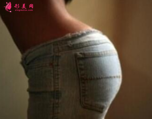 臀部吸脂什么時候恢復好