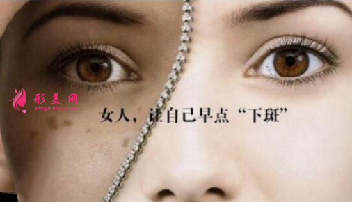 激光祛斑會(huì)不會(huì)出現(xiàn)后遺癥