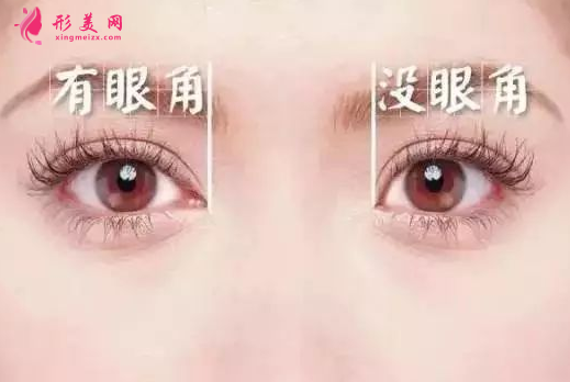 開眼角是不是會留疤