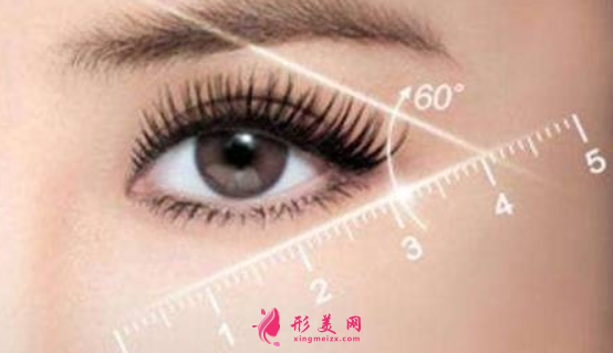 開眼角術(shù)后多久可以拆線