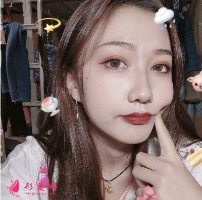 雙眼皮整形