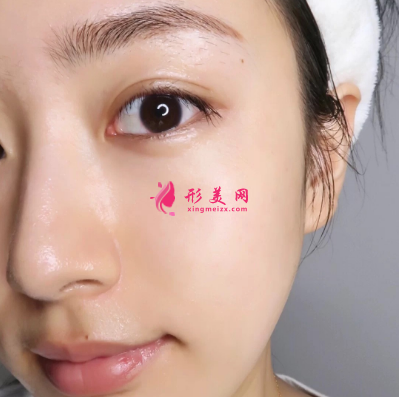 武漢美亞整形醫(yī)院謝大明面部除皺