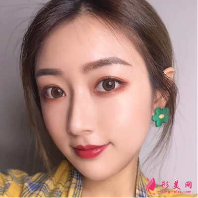 武漢美亞整形醫(yī)院謝大明面部除皺
