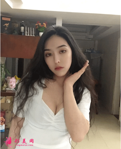 北京葉子整形醫(yī)院魯禮新隆胸 隆胸三個(gè)月后