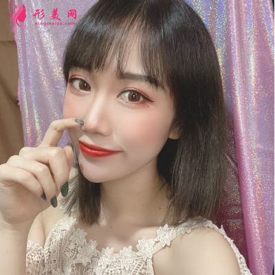 深圳福華整形醫(yī)院李敏雙眼皮