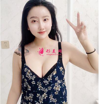 隆胸