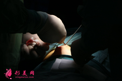 北京知音整形醫(yī)院馬群做鼻綜合