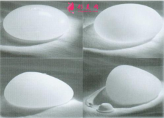 假體隆胸效果什么時(shí)候穩(wěn)定？