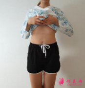 成都玉之光大腿吸脂案例分享，瘦腿就是這么簡單！