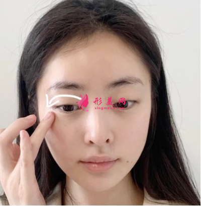 武漢華亞整形醫(yī)院李愛林面部除皺