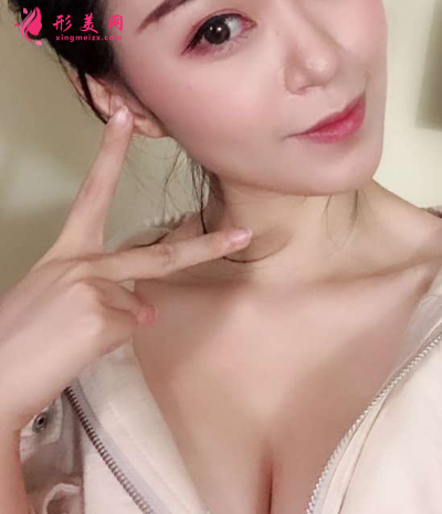武漢禾麗康美整形醫(yī)院徐庶隆胸 武漢禾麗康美整形醫(yī)院徐庶隆胸