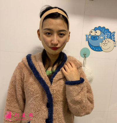 磨下頜角