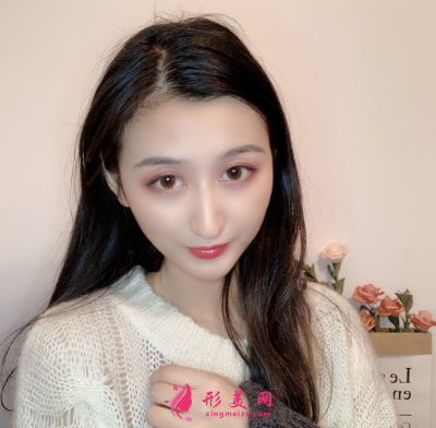 磨下頜角
