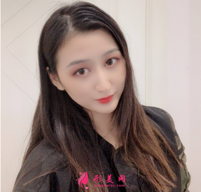 磨下頜角