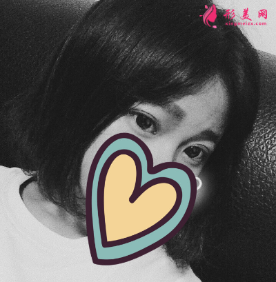 湖北省中醫(yī)院整形科胡霜紅雙眼皮 湖北省中醫(yī)院整形科胡霜紅雙眼皮