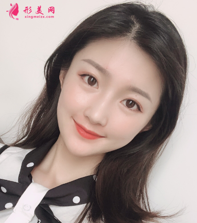 成都華美、藝星、美萊做面部自體脂肪填充怎么樣？哪個(gè)醫(yī)生好