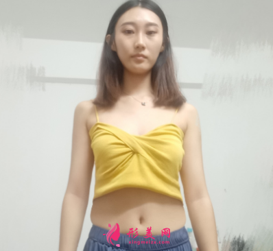 重慶美圣美邦整形醫(yī)院任志偉腰腹吸脂 重慶美圣美邦整形醫(yī)院任志偉腰腹吸脂