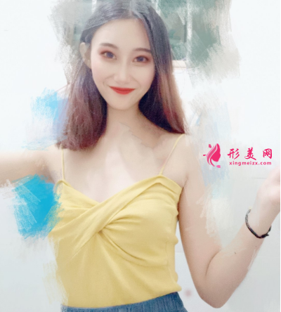 重慶美圣美邦整形醫(yī)院任志偉腰腹吸脂 重慶美圣美邦整形醫(yī)院任志偉腰腹吸脂