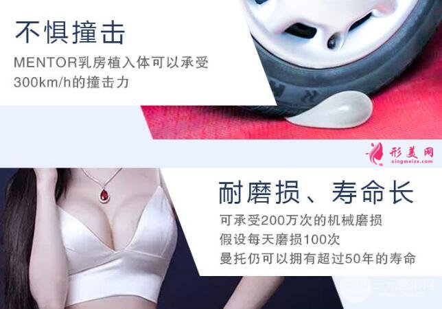 假體隆胸