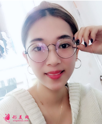 武漢韓辰整形醫(yī)院李相奇雙眼皮案例 武漢韓辰整形醫(yī)院李相奇雙眼皮案例