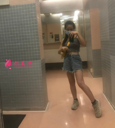 成都華人醫(yī)聯(lián)整形醫(yī)院張紅芳大腿吸脂 成都華人醫(yī)聯(lián)整形醫(yī)院張紅芳大腿吸脂