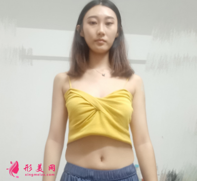 重慶美圣美邦整形醫(yī)院任志偉腰腹吸脂 重慶美圣美邦整形醫(yī)院任志偉腰腹吸脂
