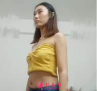 重慶美圣美邦任志偉做腰腹吸脂，還你一個(gè)迷人小蠻腰哦~