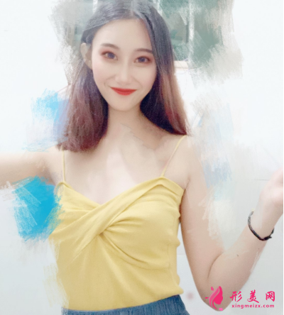 重慶美圣美邦整形醫(yī)院任志偉腰腹吸脂 重慶美圣美邦整形醫(yī)院任志偉腰腹吸脂