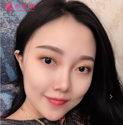 水光針