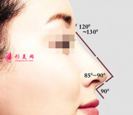 隆鼻假體取出后怎么樣