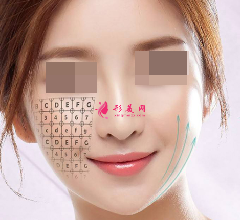 面部埋線提升有風(fēng)險(xiǎn)嗎