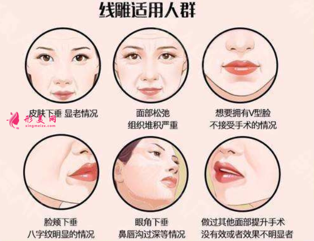 面部埋線提升有風(fēng)險(xiǎn)嗎