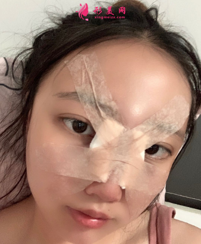 上海東方麗人整形醫(yī)院喬海初隆鼻 上海東方麗人整形醫(yī)院喬海初隆鼻