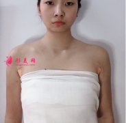 上海華美整形醫(yī)院的豐胸技術如何?性感身材讓我找到了愛情